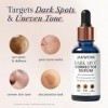 Dark Spot Remover for Face with Niacinamide - Dark Spot Corrector & Melasma Face Sérum - Skin Care for Hyperpigmentation 30ml