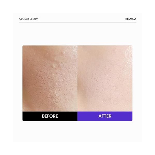 Frankly Sérum Closer - 9 peptides & collagène végétalien, minimiseur de pores & anti-âge, hydratant pour la peau profonde, ve