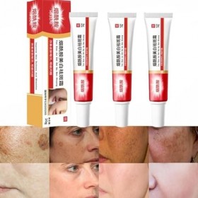 Lot de 3 crèmes pour Las Manchas de La Cara, Cremas para Quitar Manchas de La Cara, Crema Blanqueadora para Pecas, Elimina el