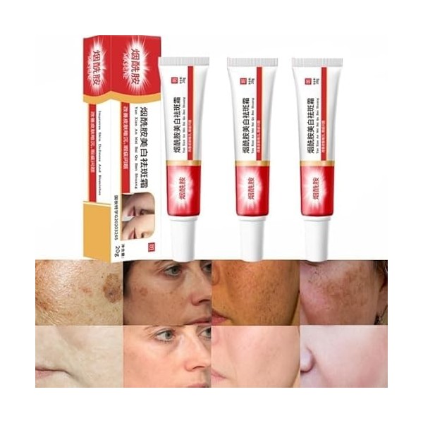 Lot de 3 crèmes pour Las Manchas de La Cara, Cremas para Quitar Manchas de La Cara, Crema Blanqueadora para Pecas, Elimina el