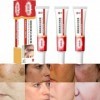 Lot de 3 crèmes pour Las Manchas de La Cara, Cremas para Quitar Manchas de La Cara, Crema Blanqueadora para Pecas, Elimina el