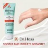 Dr. Hess Hydratant pour la peau sujette aux diabétiques pour hydratant unisexe 113,4 g
