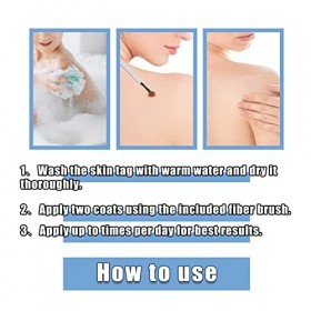 Liquide Délimination Des Verrues,Liquide Anti Verrues,Sérums Délimination Des Acrochordons,Pour Les Types De Peau,30ml