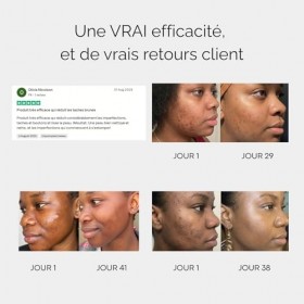 Sérum anti-imperfections au Curcuma - 30ml