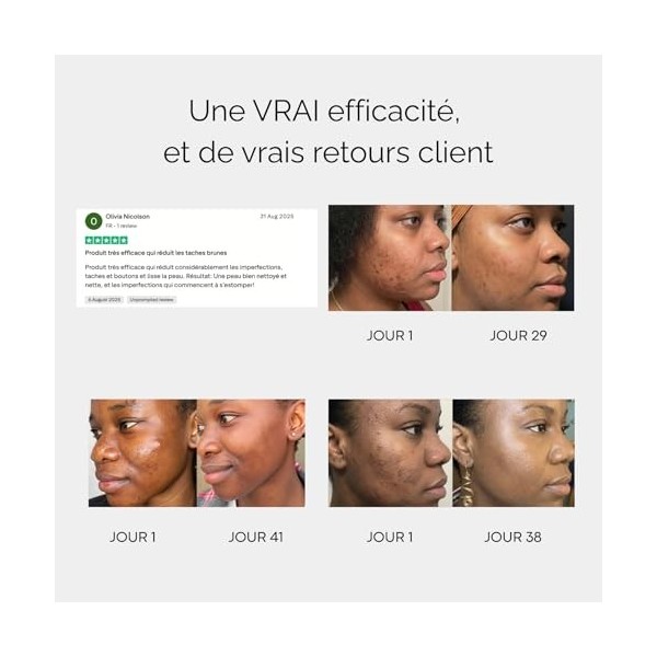 Sérum anti-imperfections au Curcuma - 30ml