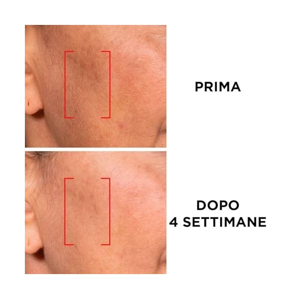 LOréal Paris Revitalift Laser Soin de jour SPF 25 Soin du visage anti-âge triple action avec vitamine C & Pro-Retinol 50ml