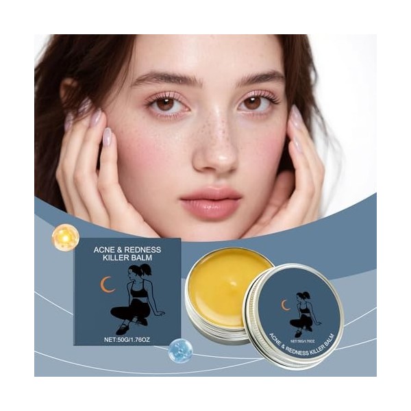 Baume anti-acné bio, doux et apaisant, soin ultra-performant, hydratation longue durée, pour peaux sensibles et grasses Crème...