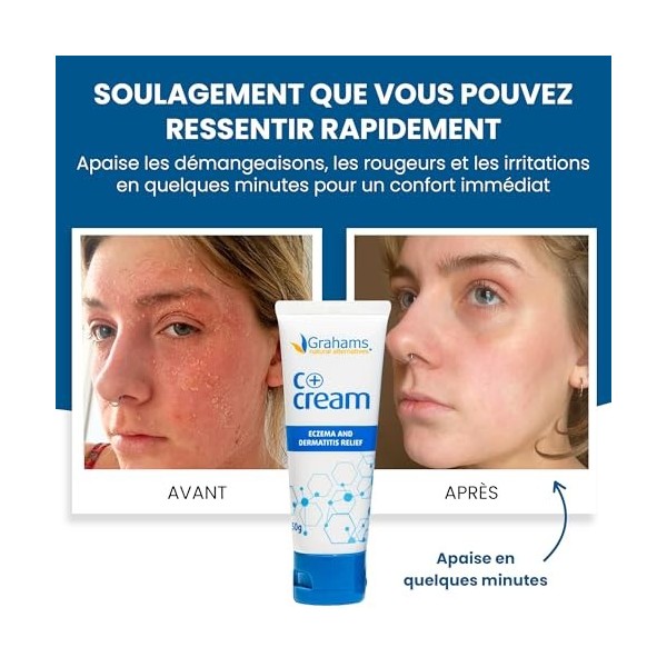 Grahams Natural C+ Cream - Pour Peaux Sèches, Démangeantes, Rouges et à Tendance Eczémateuse - Au Miel de Manuka et au Calend