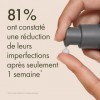 Origins Clear Improvement Lotion Hydratante Anti-Imperfections | Pour éliminer et prévenir les boutons et les éruptions cutan