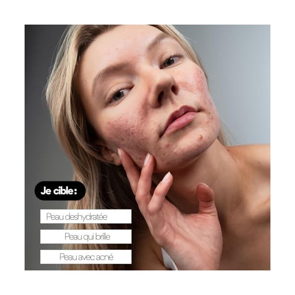 Skin & Out Feed OUT – Crème Hydratante Peaux Mixtes à Grasses – 99% d’Origine Naturelle – Hydrate, Apaise les boutons, Régule...