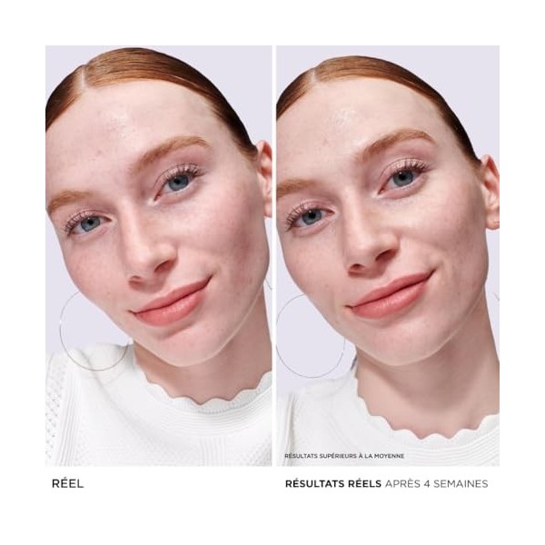 IT COSMETICS, Sérum Anti-Rougeurs Bye Bye Redness, À lAvoine Colloïdale, Apaise, Hydrate et Agit Instantanément, Vegan, Non