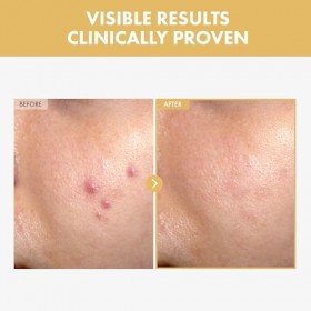 TOSOWOONG Sérum hydratant pour le visage Black Snail Ginseng 30ml 1,01 fl. Oz.