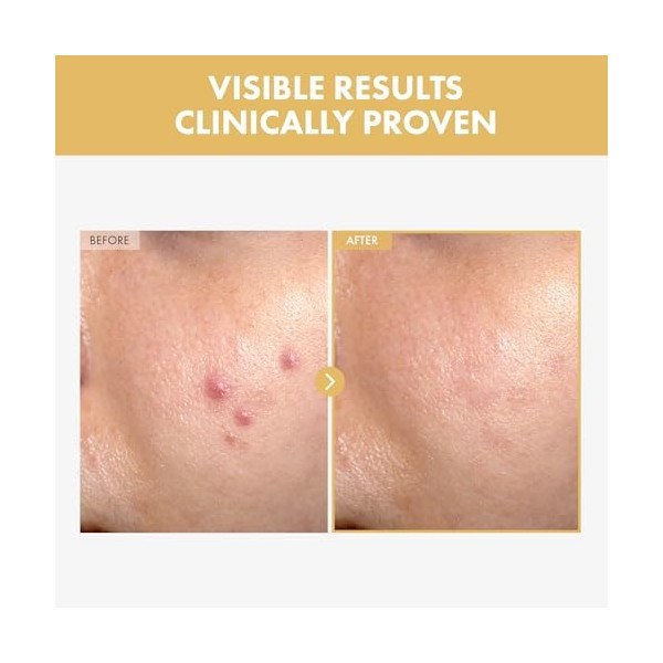 TOSOWOONG Sérum hydratant pour le visage Black Snail Ginseng 30ml 1,01 fl. Oz.