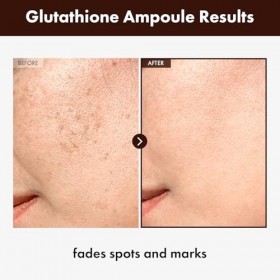 TOSOWOONG Sérum au Glutathion 20 000 ppm, avec Niacinamide et Acide Hyaluronique, Taches pigmentaires, Élasticité de la peau,
