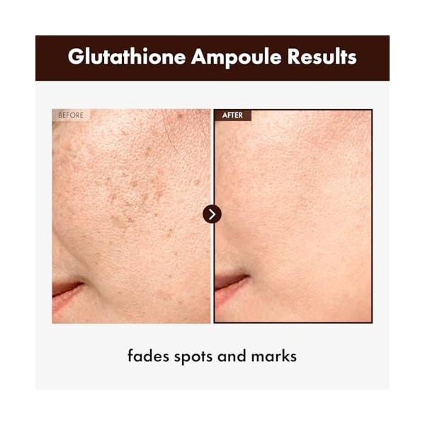 TOSOWOONG Sérum au Glutathion 20 000 ppm, avec Niacinamide et Acide Hyaluronique, Taches pigmentaires, Élasticité de la peau,