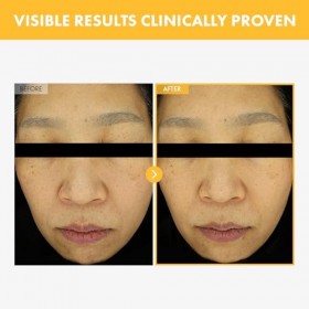 TOSOWOONG Crème anti-taches noires pour le visage Sérum anti-taches de vieillesse pour femmes et hommes 50g 1,76 oz