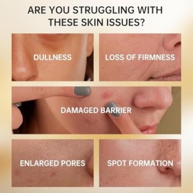 VGO Sérum au rétinol, double ingrédients actifs uniques de rétinol et de niacinamide, effet synthétique exceptionnel pour réd