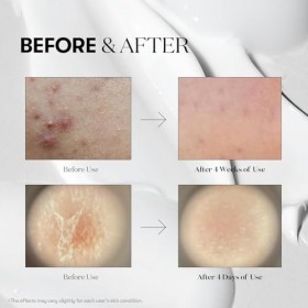 REEDLE SHOT 300, Face Serum, 50 ml - Made in KOREA 