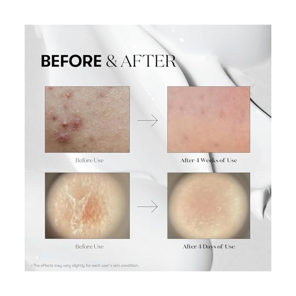 REEDLE SHOT 300, Face Serum, 50 ml - Made in KOREA 