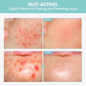 NATUREKIND Heartleaf Tea Tree Tok, Sérum tonique apaisant, Centella Asiatica, Soin visage coréen pour pores, Nourrissant et a