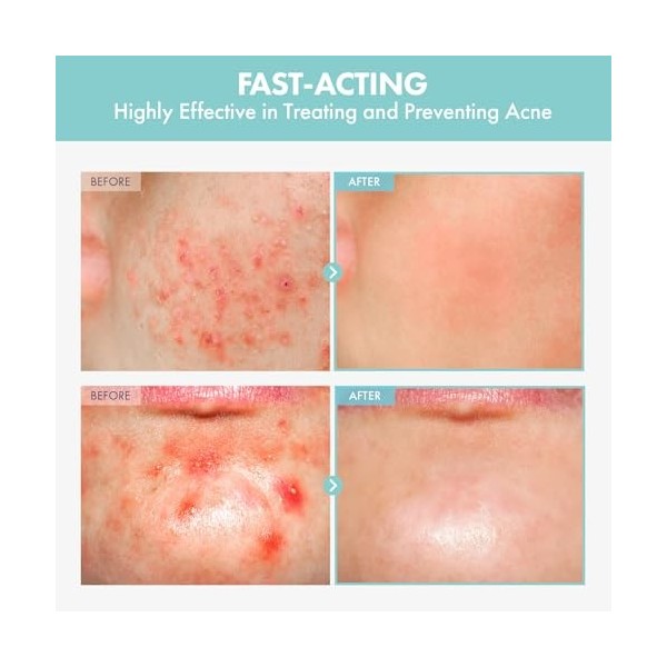 NATUREKIND Heartleaf Tea Tree Tok, Sérum tonique apaisant, Centella Asiatica, Soin visage coréen pour pores, Nourrissant et a