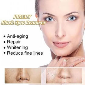 Dissolvant De Taches Noires, SéRum Anti-Taches De Rousseur, éClaircit Le Teint InéGal, SéRum Blanchissant Les Taches De Rouss...