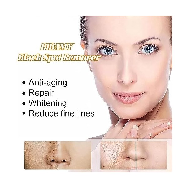 Dissolvant De Taches Noires, SéRum Anti-Taches De Rousseur, éClaircit Le Teint InéGal, SéRum Blanchissant Les Taches De Rouss...