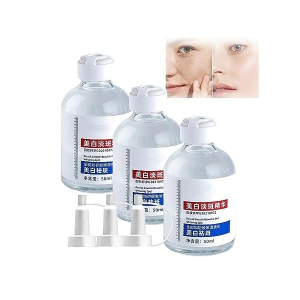 Dissolvant De Taches Noires, SéRum Anti-Taches De Rousseur, éClaircit Le Teint InéGal, SéRum Blanchissant Les Taches De Rouss...