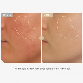 TOSOWOONG Sérum éclat au riz véritable, contenant 80% d’eau de son de riz et de la niacinamide, pour une peau uniforme, un te