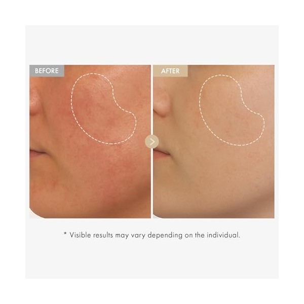 TOSOWOONG Sérum éclat au riz véritable, contenant 80% d’eau de son de riz et de la niacinamide, pour une peau uniforme, un te