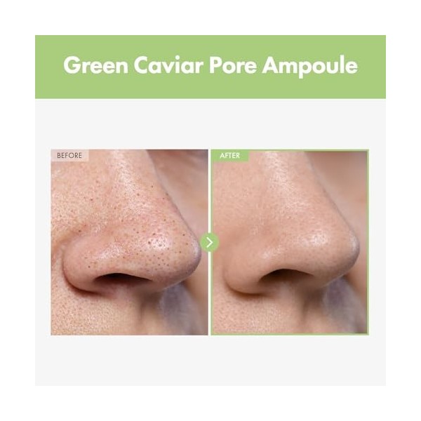 TOSOWOONG Ampoule à pores de caviar vert avec minimisateur de pores au niacinamide au caviar vert de 2500 ppm, 33ml, 1,11 fl.
