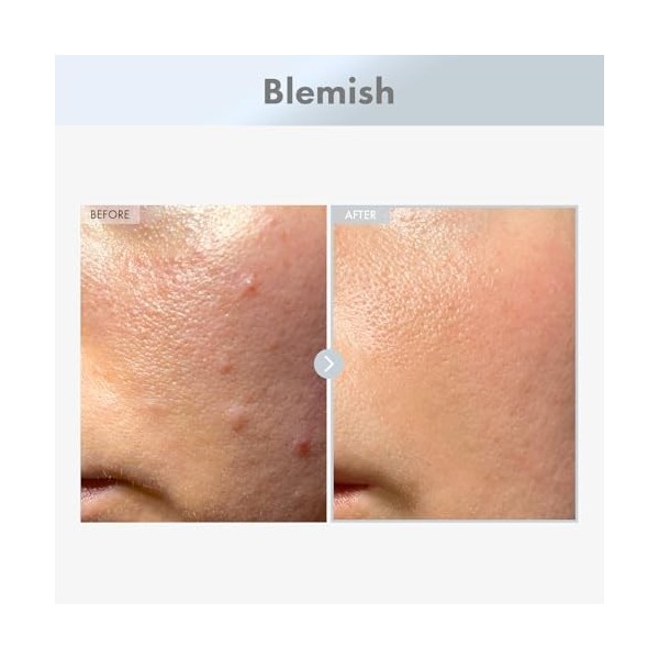 TOSOWOONG Sérum pour le visage à 15% de niacinamide, correcteur des taches brunes, 30ml, 1,01 fl.oz.