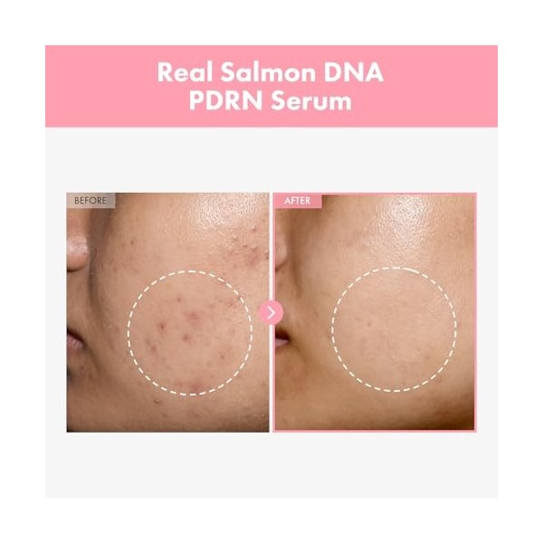 TOSOWOONG Sérum Pink Peptide 12 Pdrn avec ADN de saumon 33ml 1,11 fl.oz.