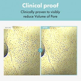 TOSOWOONG Crème Pore Refiner Crème pour le visage Extracteur de pores Minimisation, réduction et élimination des pores 50g 1,