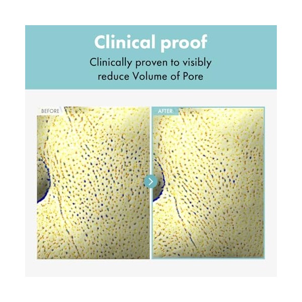TOSOWOONG Crème Pore Refiner Crème pour le visage Extracteur de pores Minimisation, réduction et élimination des pores 50g 1,