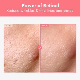 NATUREKIND Crème au rétinol, Rétinol liposomal 0,1%, Bakuchiol, Rétinal, Niacinamide, Bakuchiol, Retinal, Niacinamide, Visage