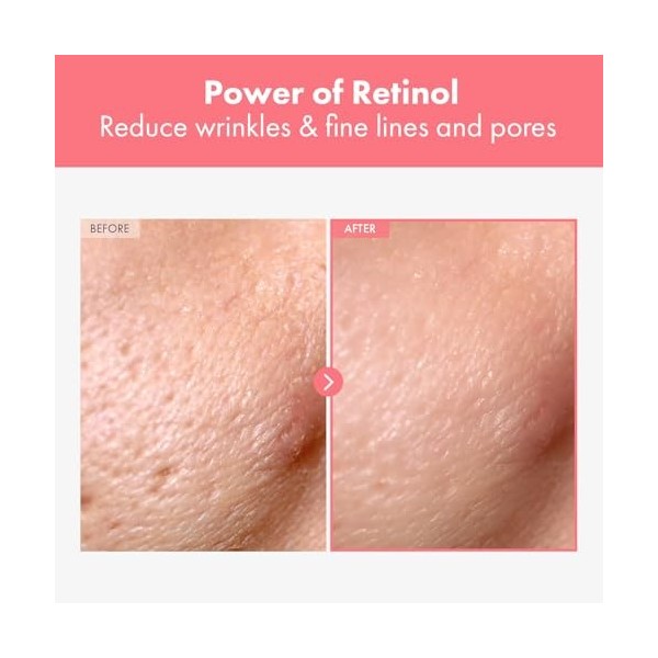 NATUREKIND Crème au rétinol, Rétinol liposomal 0,1%, Bakuchiol, Rétinal, Niacinamide, Bakuchiol, Retinal, Niacinamide, Visage