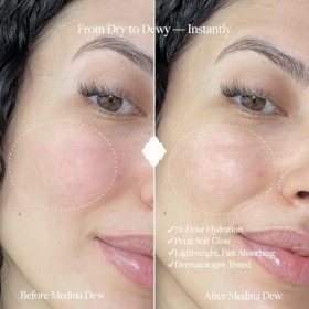 WHIND Medina Dew Crème hydratante pour le visage à leau de rose et à lacide hyaluronique – Hydratant doux et léger pour une