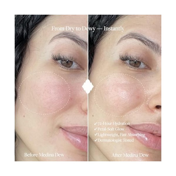 WHIND Medina Dew Crème hydratante pour le visage à leau de rose et à lacide hyaluronique – Hydratant doux et léger pour une