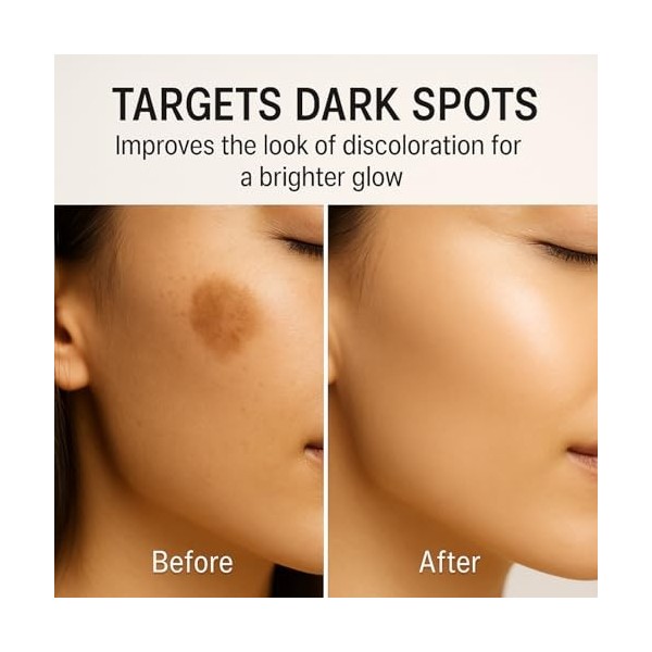 Sérum visage à l’acide kojique, niacinamide et curcuma, correcteur de taches, sérum éclaircissant, booster d’éclat, hydratant...