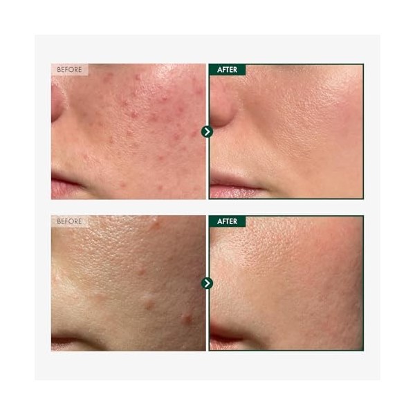 Madagascar Centella 86% Ampoule avec 860,048ppm Centella Asiatica, Sérum hydratant et rafraîchissant pour le visage, Convient