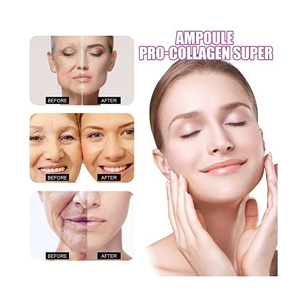 Collagen Concentrate Ampoule Serum, With Aloe To Lift And Firm, Collagen Production, 7 Days To Firmer Skin, Reduces Fine Line...