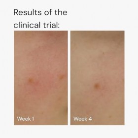 More Moisture Face Sérum