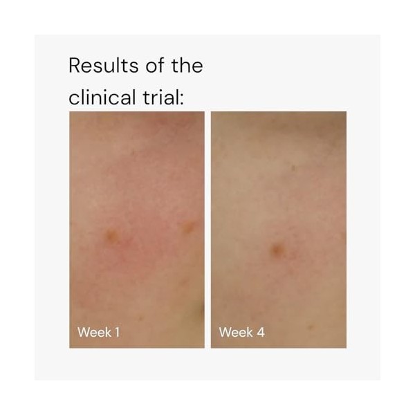 More Moisture Face Sérum