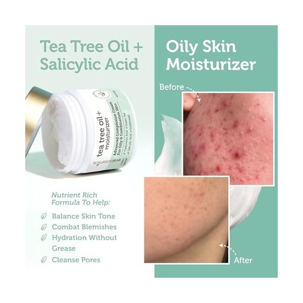 Tea Tree Oil Face Cream - For Oily, Acne Prone Skin 2oz Natural & Organic Facial Moisturizer with 7X Ingredients For Rosacea,