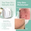 Tea Tree Oil Face Cream - For Oily, Acne Prone Skin 2oz Natural & Organic Facial Moisturizer with 7X Ingredients For Rosacea,