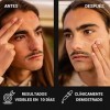 HURRRICANE. Crème anti-acné naturelle pour les hommes. Réduit les boutons et les points noirs. Crème légère avec 29 ingrédien