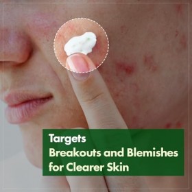 TOSOWOONG Crème à la Centella de Madagascar, 706 580 ppm de Centella asiatica, Hydratation longue durée, Soin doux et renforc