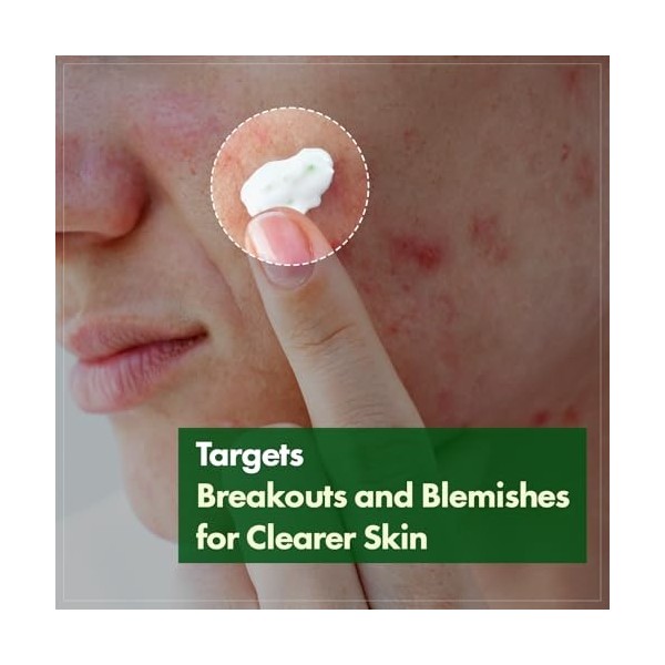 TOSOWOONG Crème à la Centella de Madagascar, 706 580 ppm de Centella asiatica, Hydratation longue durée, Soin doux et renforc