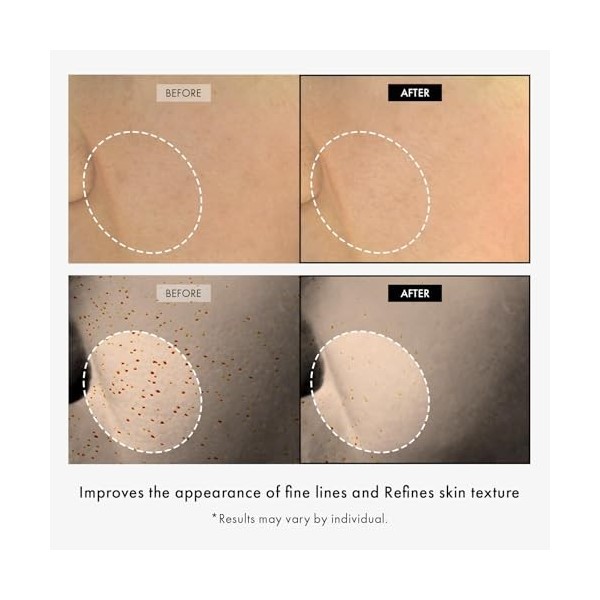 TOSOWOONG Crème au peptide de cuivre 12 – Formule à base de GHK-Cu tripeptide de cuivre-1 et complexe de peptides, crème hy